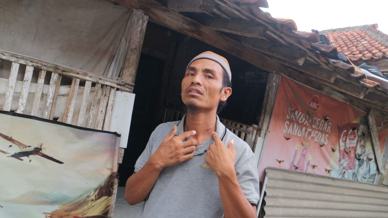 Kaderi, pedagang mie di Pasar Kolpajung Pamekasan menunjukkan luka di bagian leher akibat dugaan penganiayaan oleh kepala pasar.
