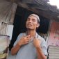 Kaderi, pedagang mie di Pasar Kolpajung Pamekasan menunjukkan luka di bagian leher akibat dugaan penganiayaan oleh kepala pasar.