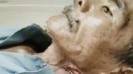 Sargi, korban kekerasan oleh istrinya sendiri saat mendapat perawatan intensif. (ISTIMEWA)
