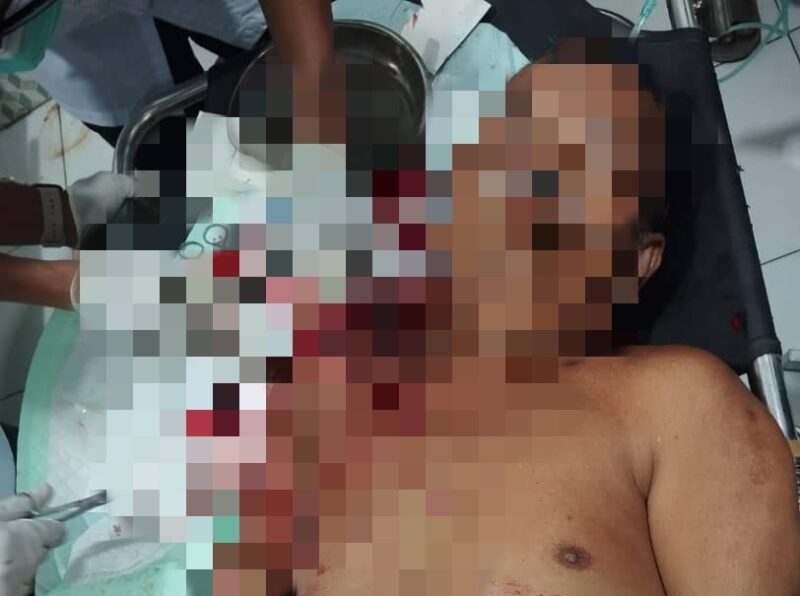 Mosleh, korban pembacokan saat menjalani perawatan intensif di RSUD Smart Pamekasan. (ISTIMEWA)