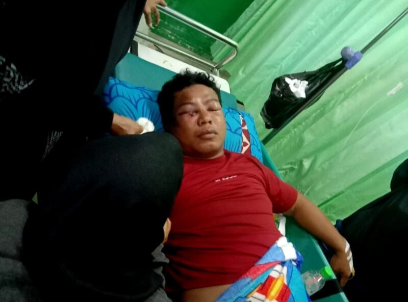Ahmad (31), warga Desa Waru Barat, Kecamatan Waru, menjalani perawatan intensif di RS Mohammad Noer Pamekasan. (ISTIMEWA)
