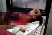 Hairuddin (29), warga asal Dusun Gung Dalem, Desa Banjar Talelah, Kecamatan Camplong terbaring lemas usai menjadi korban pembacokan. (ISTIMEWA)