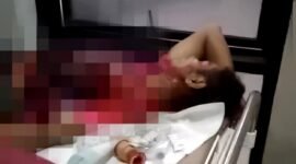 Hairuddin (29), warga asal Dusun Gung Dalem, Desa Banjar Talelah, Kecamatan Camplong terbaring lemas usai menjadi korban pembacokan. (ISTIMEWA)