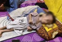 Mohammad Nur Jamil, balita berusia dua tahun asal Dusun Bendungan, Desa Tanggumong, Kecamatan Sampang menderita hedrosiphalus sejak lahir. (KLIKMADURA)