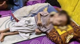 Mohammad Nur Jamil, balita berusia dua tahun asal Dusun Bendungan, Desa Tanggumong, Kecamatan Sampang menderita hedrosiphalus sejak lahir. (KLIKMADURA)