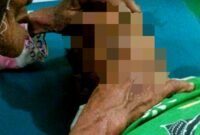 Mohammad Kenzi, bocah lima tahun yang meninggal dunia akibat diserang monyet peliharaan. (KLIKMADURA)