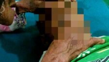 Mohammad Kenzi, bocah lima tahun yang meninggal dunia akibat diserang monyet peliharaan. (KLIKMADURA)