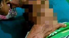 Mohammad Kenzi, bocah lima tahun yang meninggal dunia akibat diserang monyet peliharaan. (KLIKMADURA)