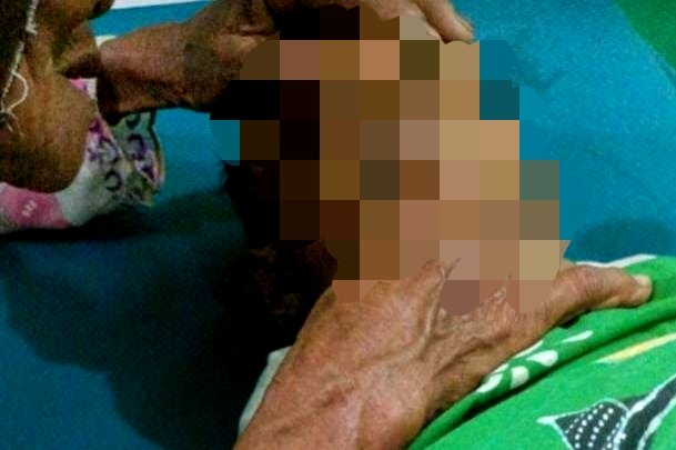 Mohammad Kenzi, bocah lima tahun yang meninggal dunia akibat diserang monyet peliharaan. (KLIKMADURA)